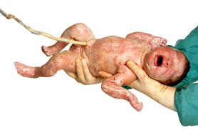 Foto di neonato di Oliviero Toscani