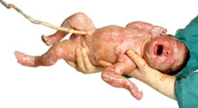 Foto di neonato di Oliviero Toscani