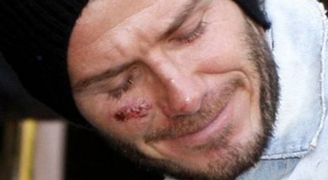 David Beckham
